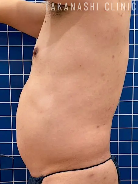 施術前（別角度2）