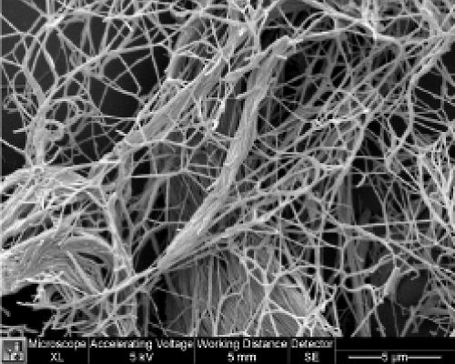 電子顕微鏡写真：ヒトのコラーゲン組織構造