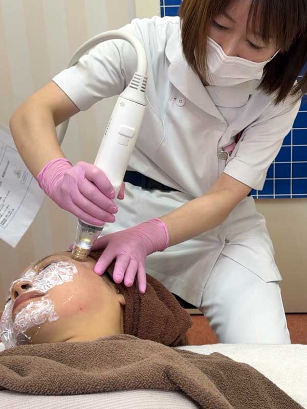 施術イメージ